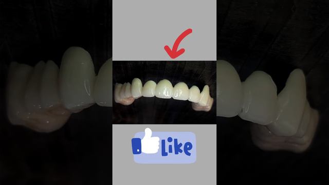 Before and after dental capping...