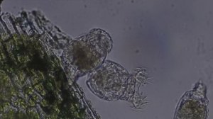 Стая хищных коловраток (на кусочке листа)