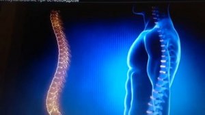 Боль в спине, боль в пояснице, онемение конечностей иглотерапевт Доктор Ким в Трускавце