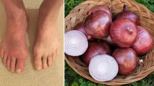 Оёк какшаб огриганда энг осон давоси