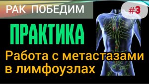 Уничтожаем метастазы в лимфоузлах. Практика. Методика ручного управления иммунитетом