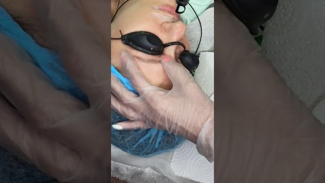 Лазерное удаление некачественного татуажа бровей Ваша Светлана Яковенко Оренбург смотреть онлайн