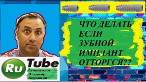 Имплант #4.Что делать если  зубной имплантат отторгся ? #Оттторжение импланта #выпал имплант