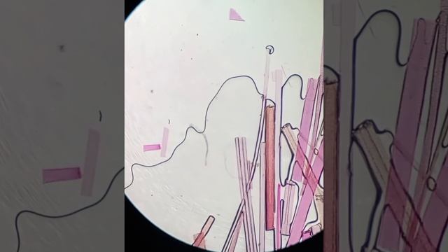 Мышиная Шерсть Под Микроскопом / Mouse Fur Under A Microscope смотреть онлайн