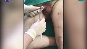 Восходящая уретрография. СНК урологии и андрологии ЛФ РНИМУ