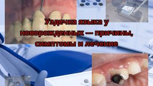 Уздечка языка у новорожденных — причины, симптомы и лечение
