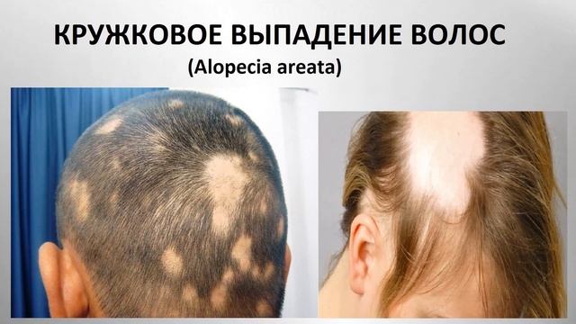 ✂️ПРОФЕССИОНАЛЬНЫЕ ЗАБОЛЕВАНИЯ ✂️ и БОЛЕЗНИ ВОЛОС.✂️