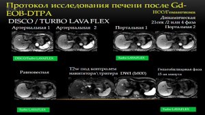 Радиология 2017. Пленарное заседание. Masui.