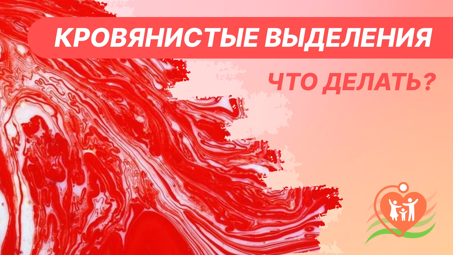 ? Кровянистые и мажущие выделения у женщин - что делать?