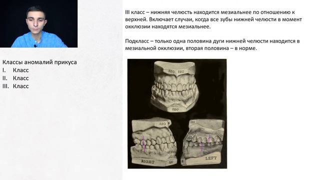 Классификация Энгля, ключи окклюзии по Эндрюсу
