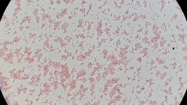ESBL Producer XDR  Strain Klebsiella pneumoniae isolation from Urine Culture and Sensitivity