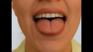 Артикуляционная гимнастика   Блинчик