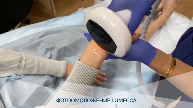 Фотоомоложение Lumecca смотреть онлайн
