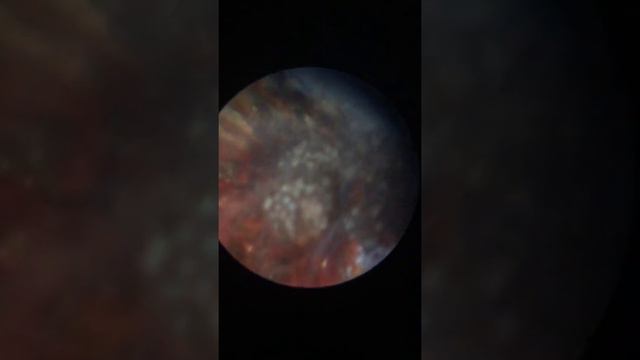 Болезни неонов под микроскопом смотреть онлайн