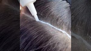 Пилинг кожи головы