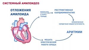 Амилоидоз - причины, симптомы, диагностика, лечение, патология