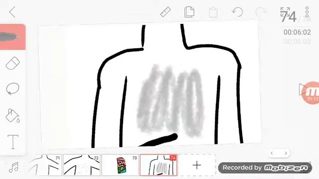 У меня аллергия на воду ( не рофл ) смотреть онлайн