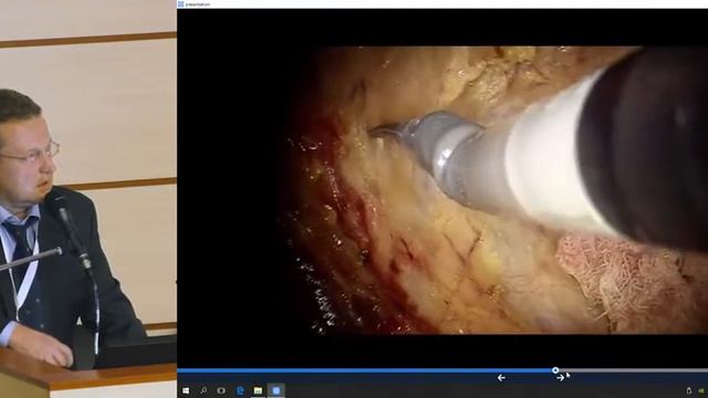 III конгресс РОСКР. Д.В.Гладышев:  Роботическая экстралеваторная БПЭ
