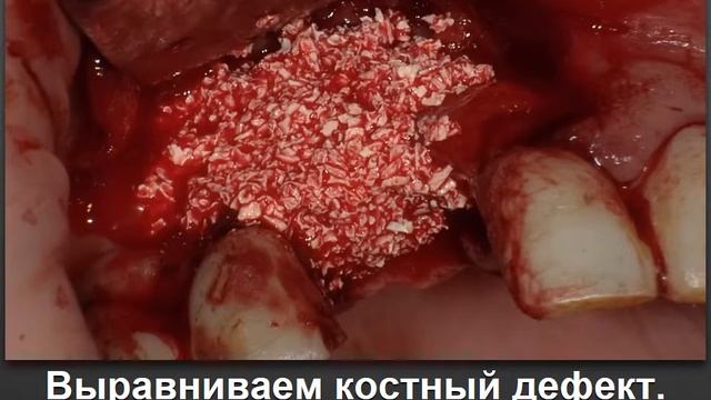 КОНЕКТБИОФАРМ-БИОИМПЛАНТ ГАП смотреть онлайн