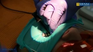 Как пользоваться апекслокатором BINGO PRO (Бинго Про)