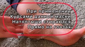 Всего 2 Ингредиента и Пятки как у Младенца!/Рецепт