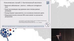 7 Заболевания кожи у детей, не требующие терапии. Оганесян О.А.