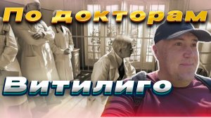 Витилиго/Как с этим жить? Диагноз 100%.Пофиг.Лечение...