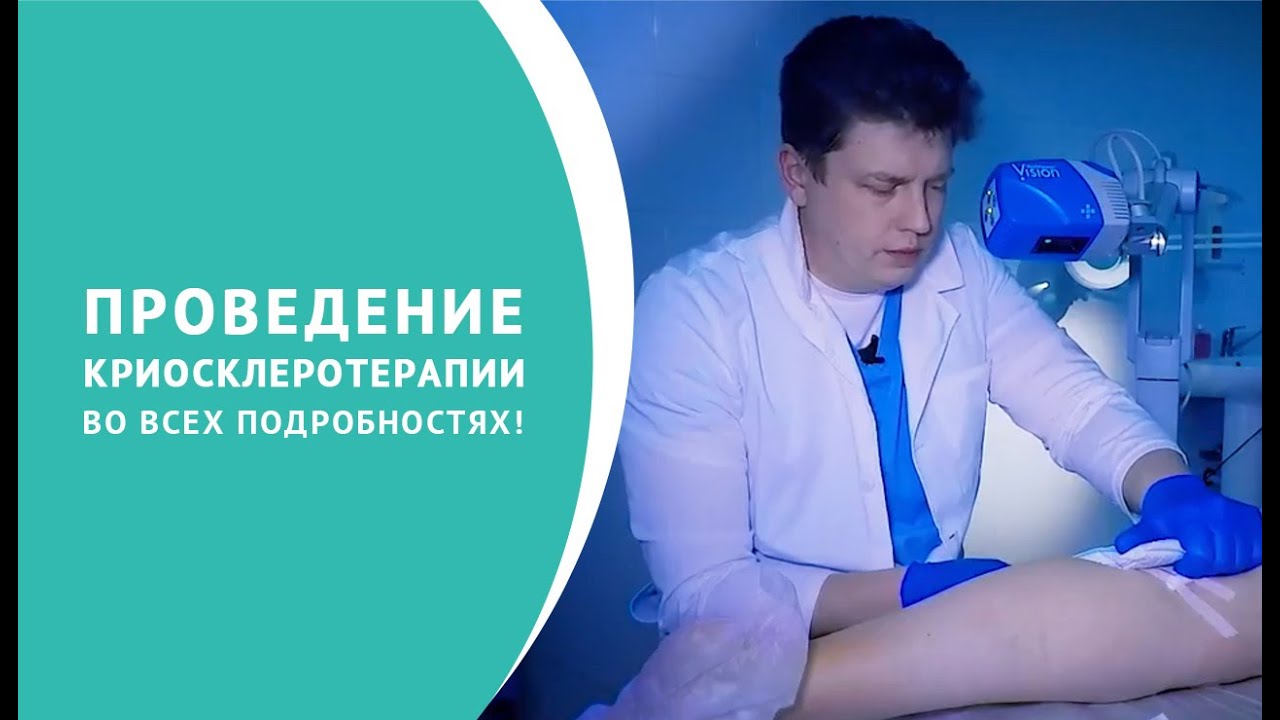 Криосклеротерапия смотреть онлайн