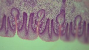 Разбор гистологического препарат: Язык листовидные сосочки