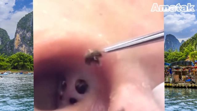 Как чистить уши 2020 смотреть онлайн