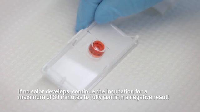 Экспресс тест на Хеликобактер пилори смотреть онлайн