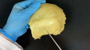 Теменная кость - Os parietale (анатомия человека)