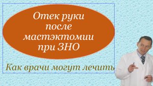 Отек руки после мастэктомии, как врачи могут лечить.  Видеобеседа для ВСЕХ и для врачей.