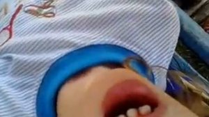 Как вырвать зуб в домашних условиях?)