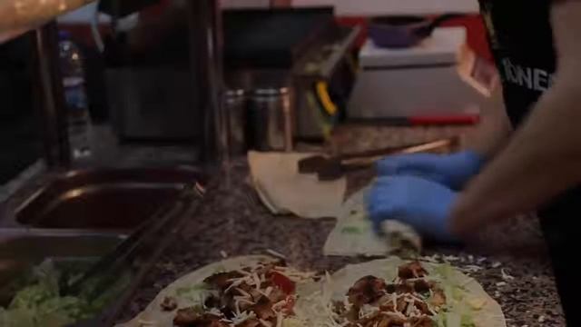 Пересадка волос в Турции (Стамбул) - Жанна Бадоева - Dr Serkan Aygin смотреть онлайн