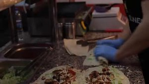 Пересадка волос в Турции (Стамбул) - Жанна Бадоева - Dr Serkan Aygin