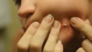 Фууу.Гной из Щеки