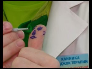 Су Джок терапия в лечении заболеваний глаз.