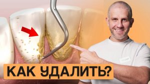 САМЫЙ эффективный способ удалить НАЛЕТ НА ЗУБАХ!