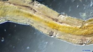 Личинка комара-звонца, косое освещение. \\ Chironomid larva, oblique lighting.