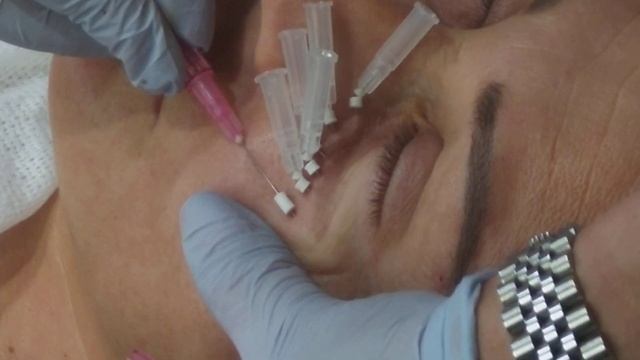 Нити. Глаза(фрагмент) смотреть онлайн