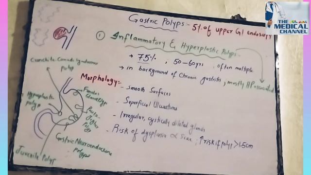 Lecture #17 Gastric Polyps|| GI Pathology ?||Best Medical Channel #Gastric Polyps #GIT polyps смотреть онлайн