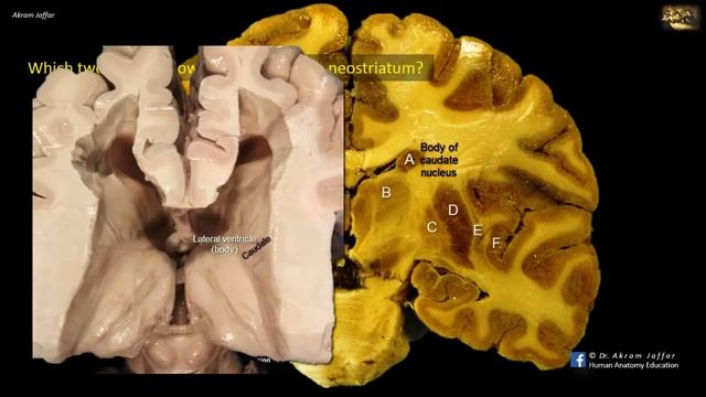 Picture Test in Neuroanatomy Brain Sections 8 смотреть онлайн
