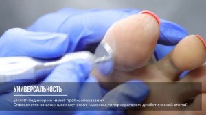 SMART-ПЕДИКЮР | Удаление трещин, натоптышей и вросших ногтей | ЦирюльникЪ Красноярск