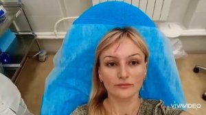 Ботокс/Инъекция/Укол красоты