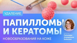 Удаление родинок, папиллом, кератом в Клинике Доктора Гурьянова / Gurianov Clinic