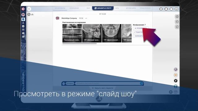 Видео №19. Использование рентген протокола в карточке пациента смотреть онлайн