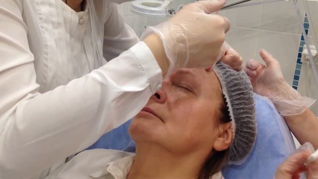 АирисКом: студенты учатся, ботокс лоб и веки смотреть онлайн