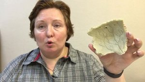 Теменная кость