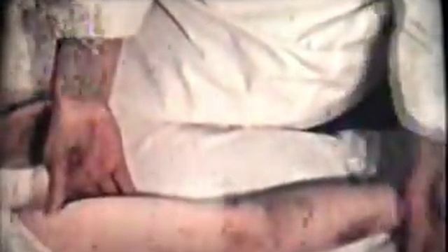 Тромбоцитопеническая пурпура у детей смотреть онлайн